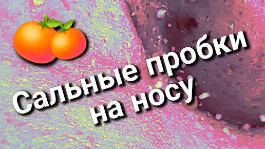 Залипательно ЛЕЗУТ 🍊 сальные пробки и комедоны!