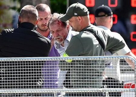    Напавший на Фицо назвал мотив своего поступка