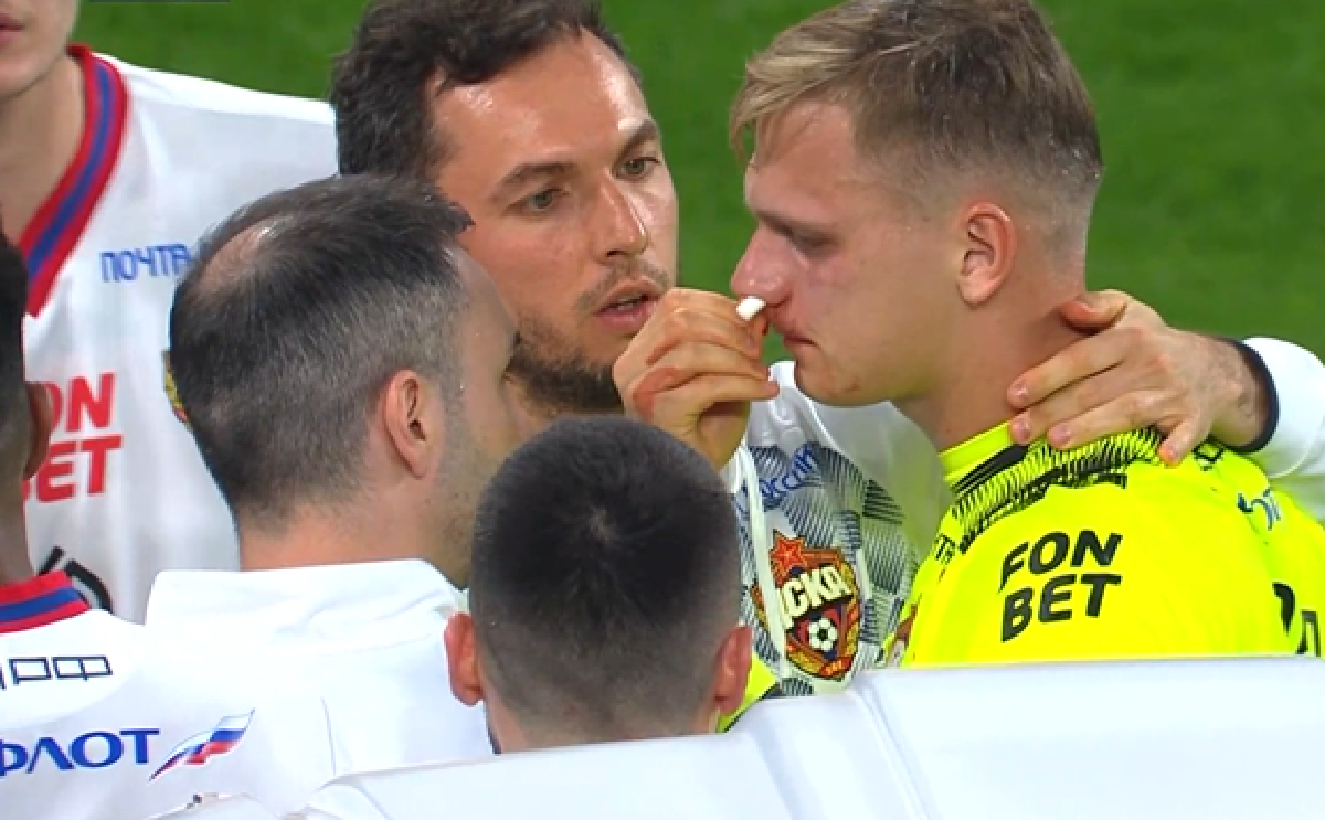 Владислав Тороп не доиграл матч с "Зенитом" из-за сотрясения мозга после столкновения с Нуралы Алипом. Фото: Матч ТВ