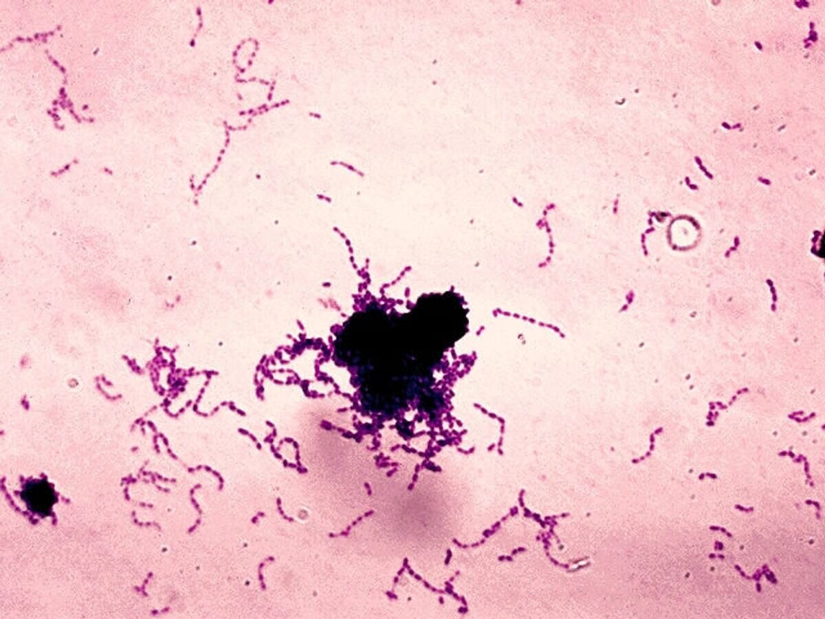    Бактерии Streptococcus mutans© Фото : public domain