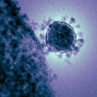 Коронавирус ближневосточного респираторного синдрома  https://upload.wikimedia.org/wikipedia/commons/thumb/e/e3/Middle_East_respiratory_syndrome-related_coronavirus.jpg/548px-Middle_East_respiratory_syndrome-related_coronavirus.jpg  https://ru.wikipedia.org/wiki/%D0%91%D0%BB%D0%B8%D0%B6%D0%BD%D0%B5%D0%B2%D0%BE%D1%81%D1%82%D0%BE%D1%87%D0%BD%D1%8B%D0%B9_%D1%80%D0%B5%D1%81%D0%BF%D0%B8%D1%80%D0%B0%D1%82%D0%BE%D1%80%D0%BD%D1%8B%D0%B9_%D1%81%D0%B8%D0%BD%D0%B4%D1%80%D0%BE%D0%BC