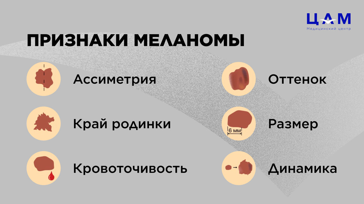 Классификация новообразований на коже — виды доброкачественных образований