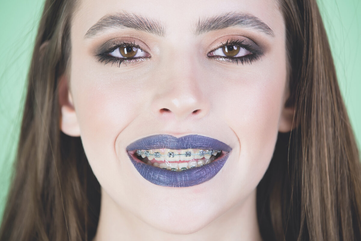 Ортодонтия