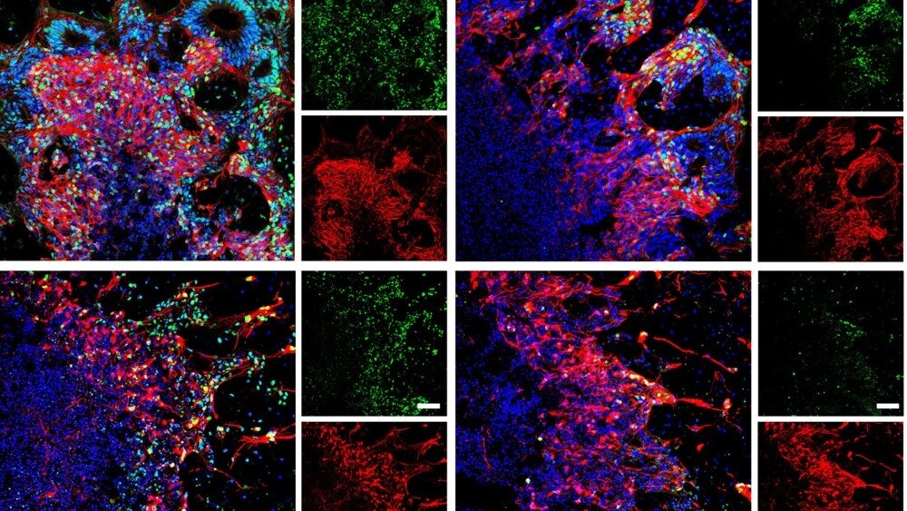    Фото: Weiwei Xue et al./Cell Reports Methods, 2024, Клетки мозга после разморозки