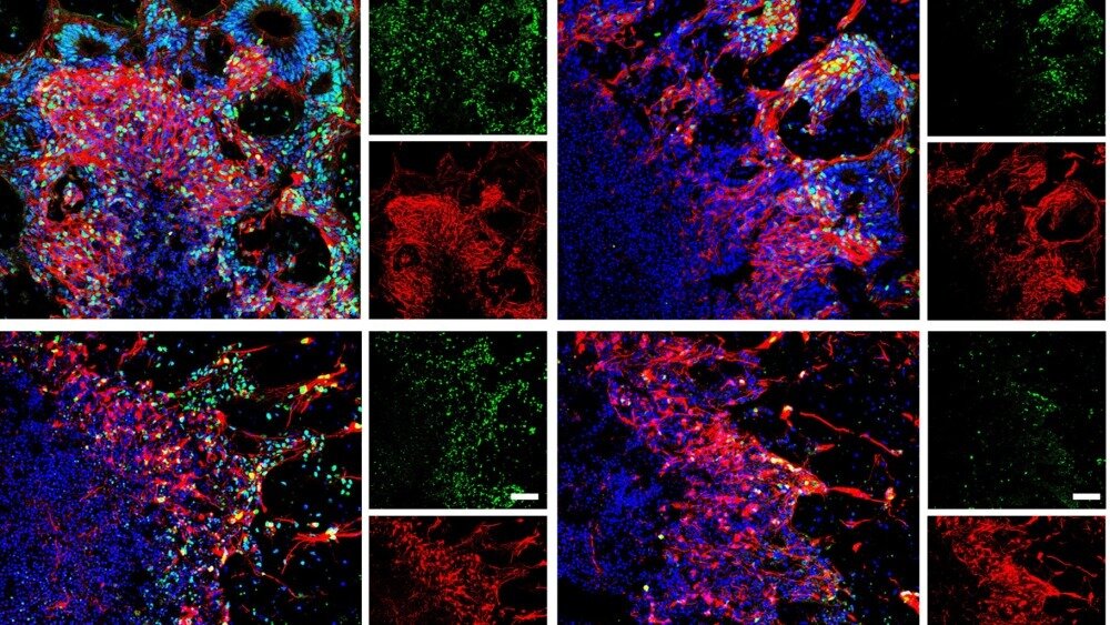    Фото: Weiwei Xue et al./Cell Reports Methods, 2024, Клетки мозга после разморозки