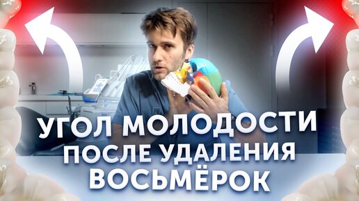 Download Video: Угол молодости после удаления зубов мудрости