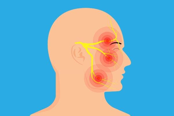 Боль при невралгии может распространяться на все области, где проходят ветви тройничного нерва