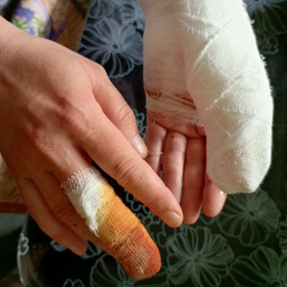 Без пострадавших не обошлось