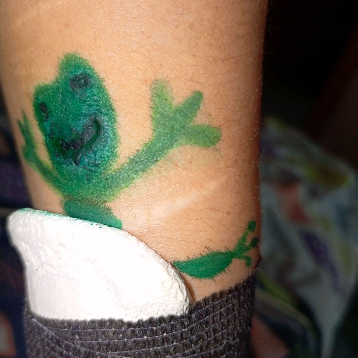 Была рана, стал лягушонок