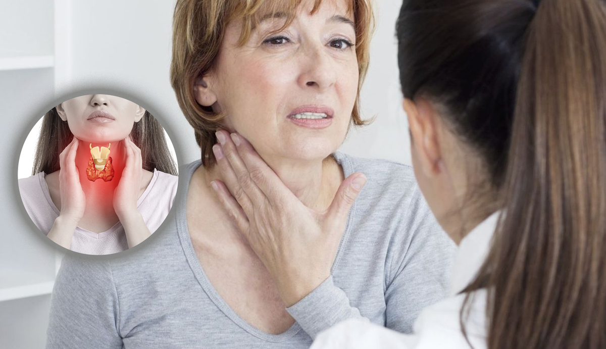 Гипотиреоз не приговор: 5 шагов к стройности и здоровью