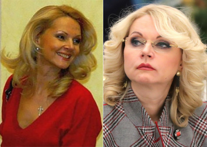 Голикова до и после пластики