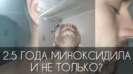 2.5 года пользованием МИНОКСИДИЛА (minoxidil) и не только. Вывод, результат и доп. информация