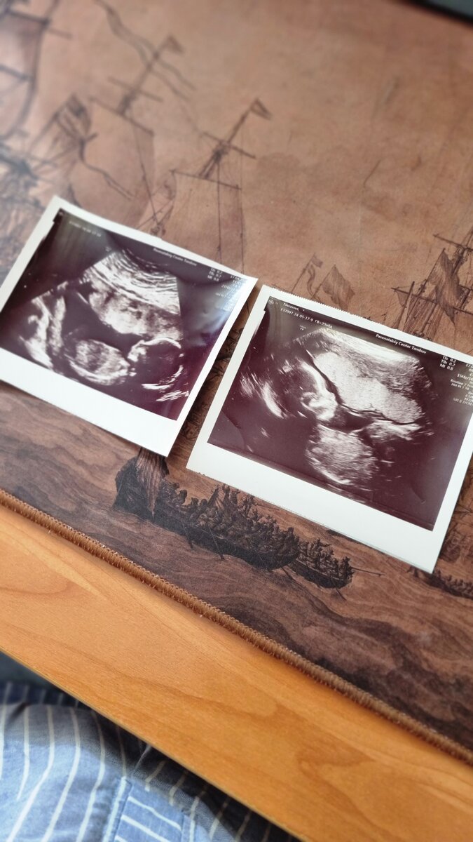 Я тут на УЗИ с мужем ездила и узнавала пол ребёнка.