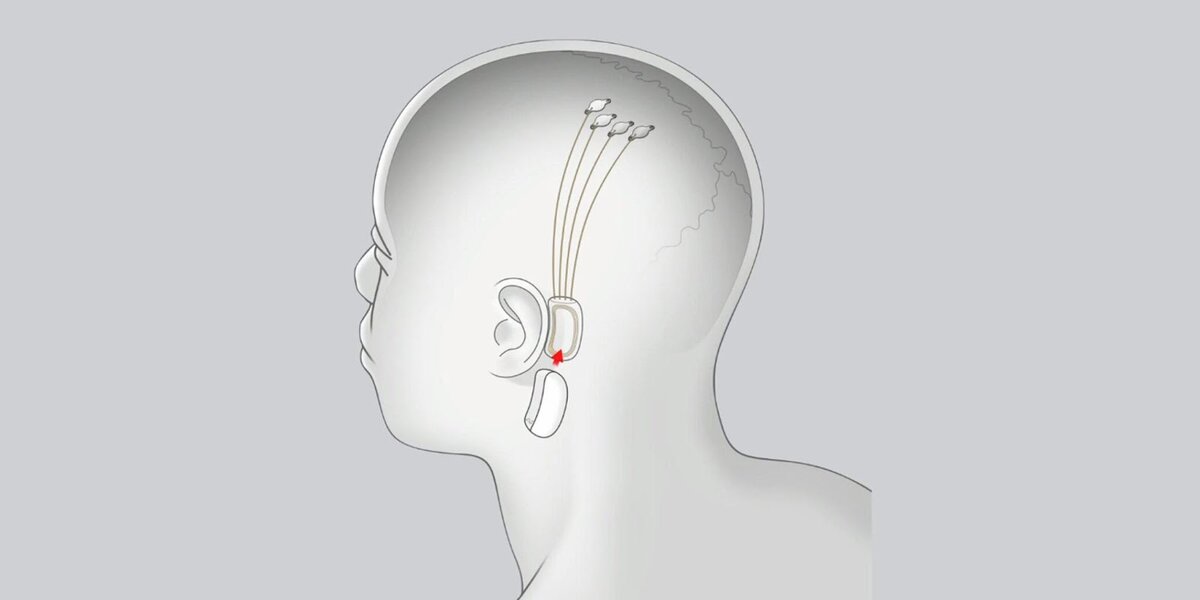  Изображение: Neuralink