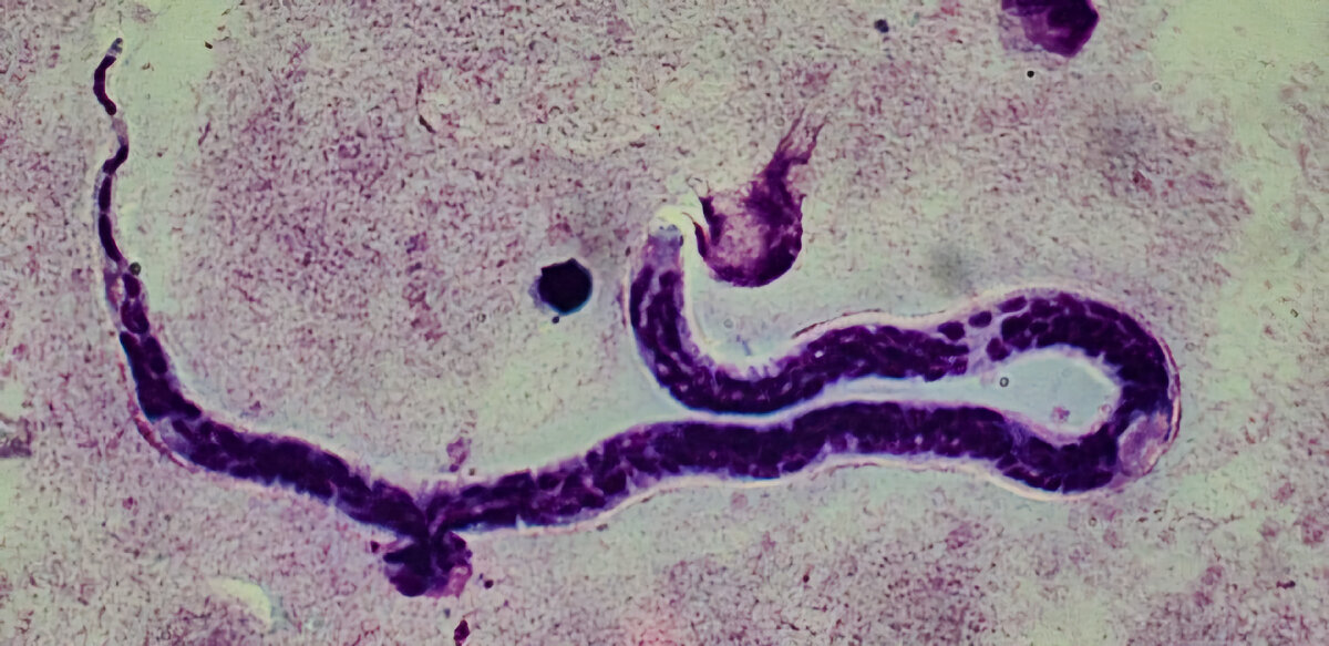 Лоа лоа под микроскопом