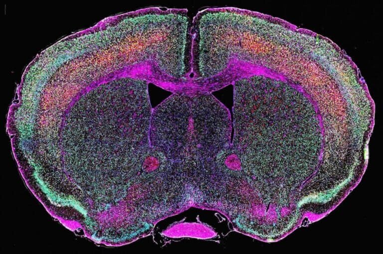    Визуализация экспрессии эндогенных ретровирусов в мозге / © Nath lab, NINDS, NIH.