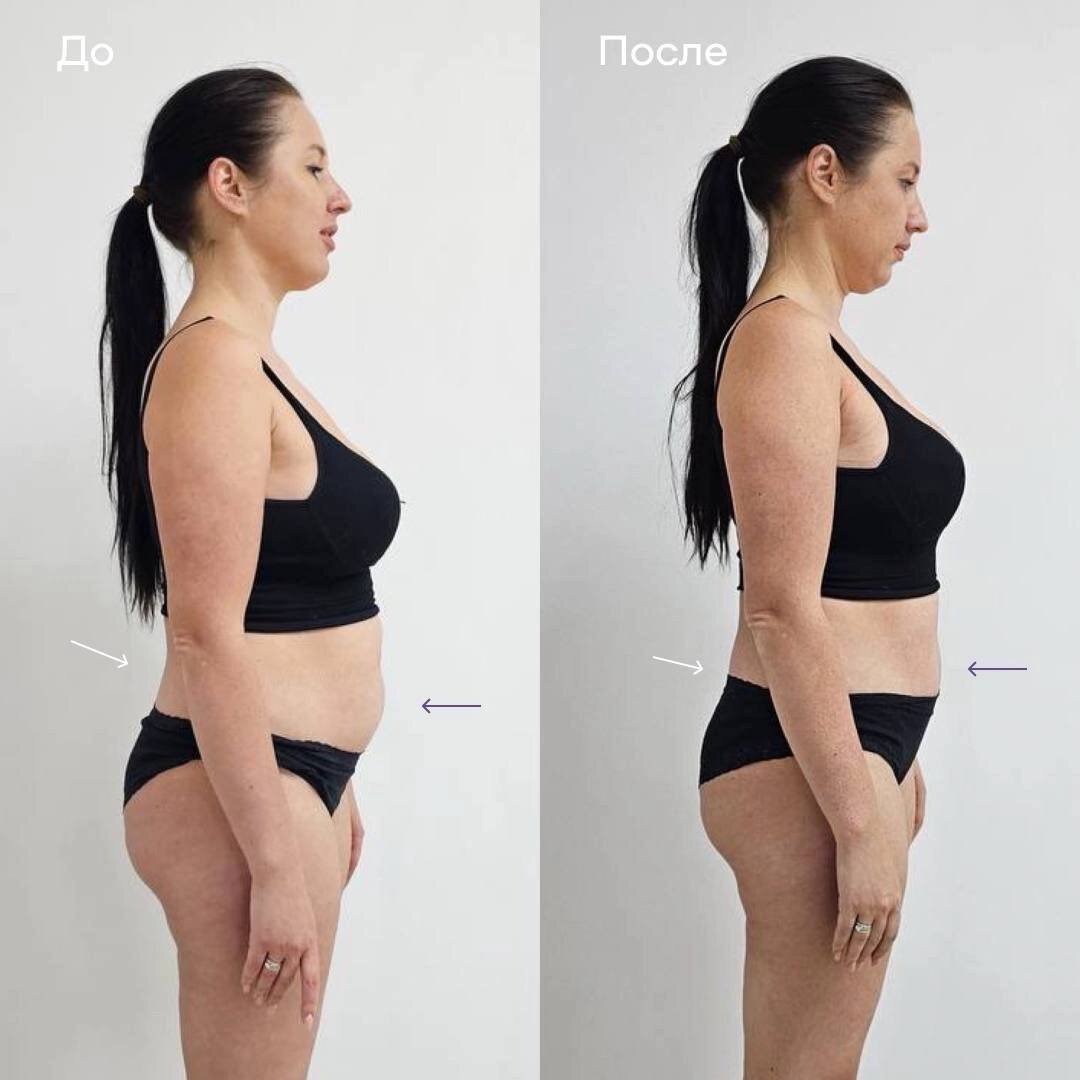 Клиника "Остео Лайт"