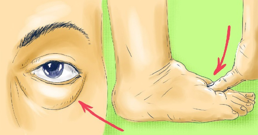 Мы задали экспертам 4 вопроса про отеки на лице и руках: вот что отвечают врачи