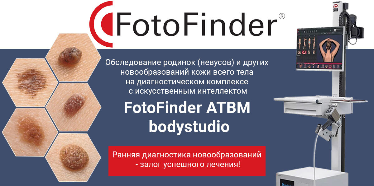 Диагностика новообразований на новейшем аппарате FotoFinder