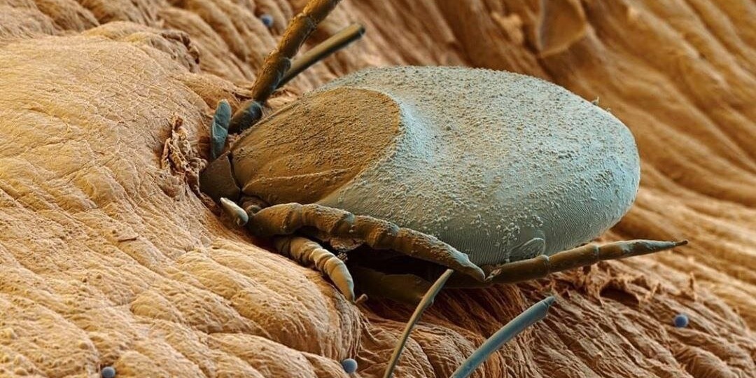 Новейшие исследования энцефалитных клещей показали кого из людей они предпочитают больше