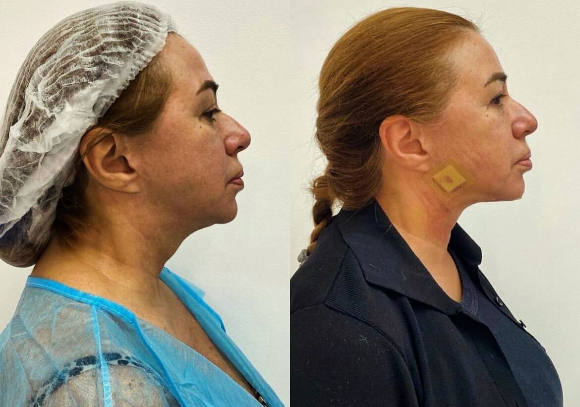 Фото: соцсети Алены Апиной/Laguna Vip