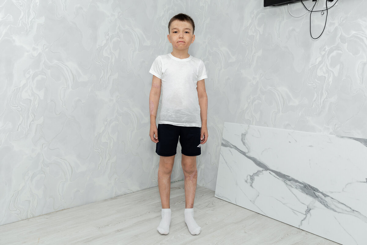 Байрас Мараканов, подопечный фонда "Алёша"