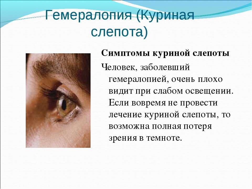 Куриная слепота возникает при недостатке какого витамина. Куриная слепота возникает при недостатке какого витамина