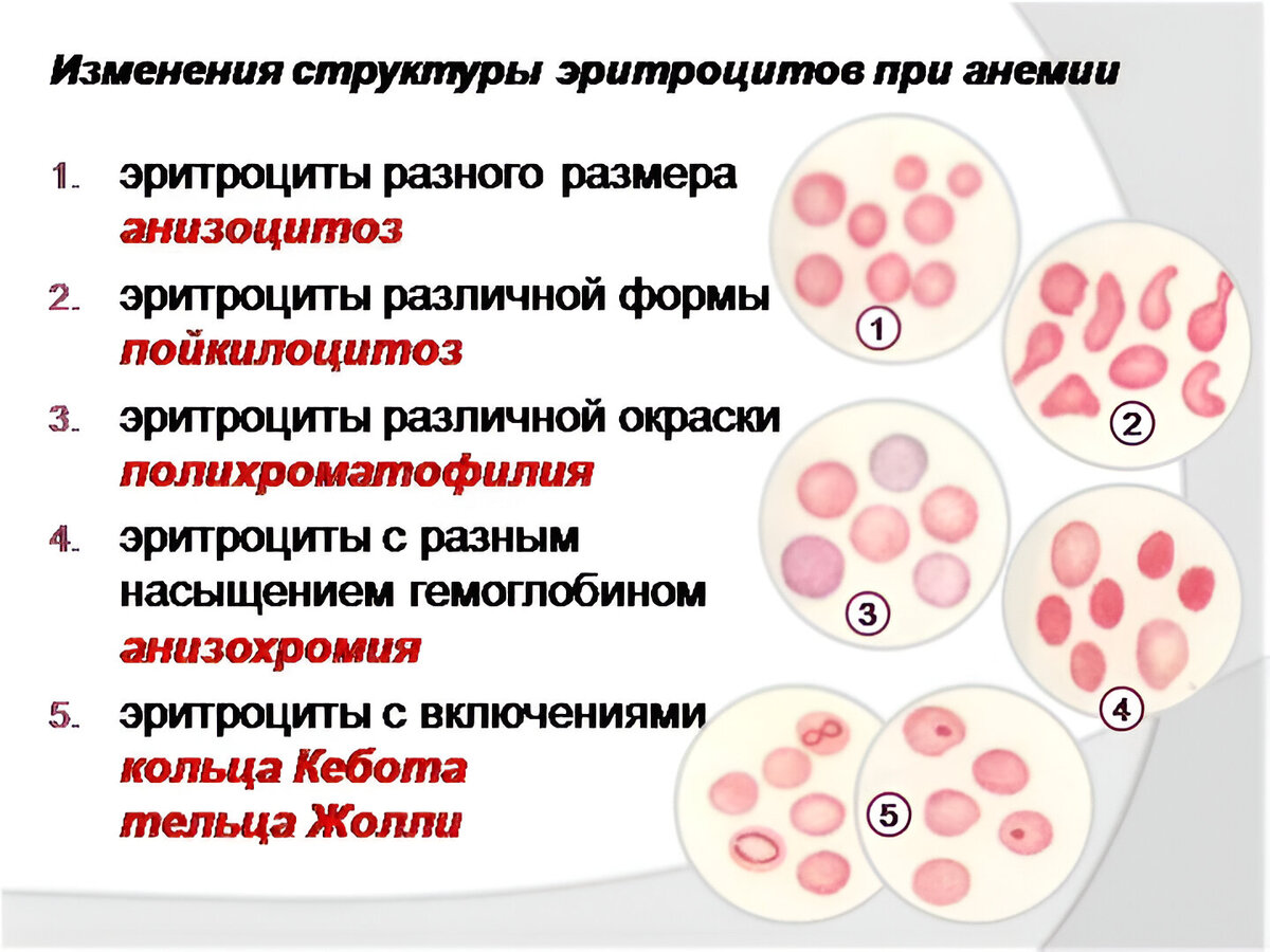 Почему возникает дефицит витамина В12: Основные причины и симптомы |  gkvector.com — медицинское и лабораторное оборудование. | Дзен