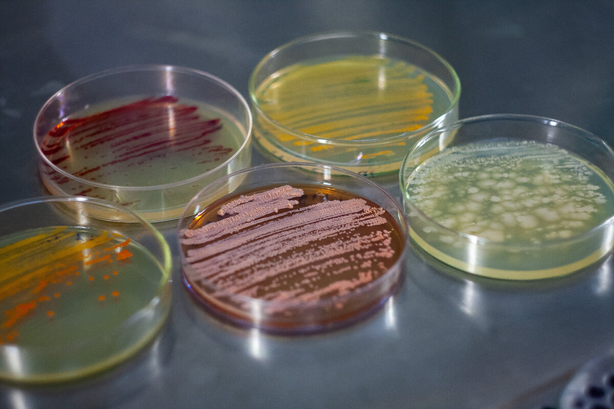 Объект исследования: бактерия Nocardia mangyaensis NH1. Источник: Татьяна Ивойлова