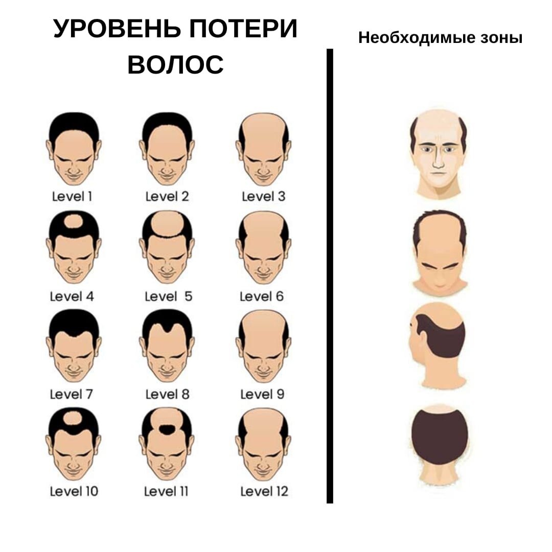 Бесплатный анализ волос 