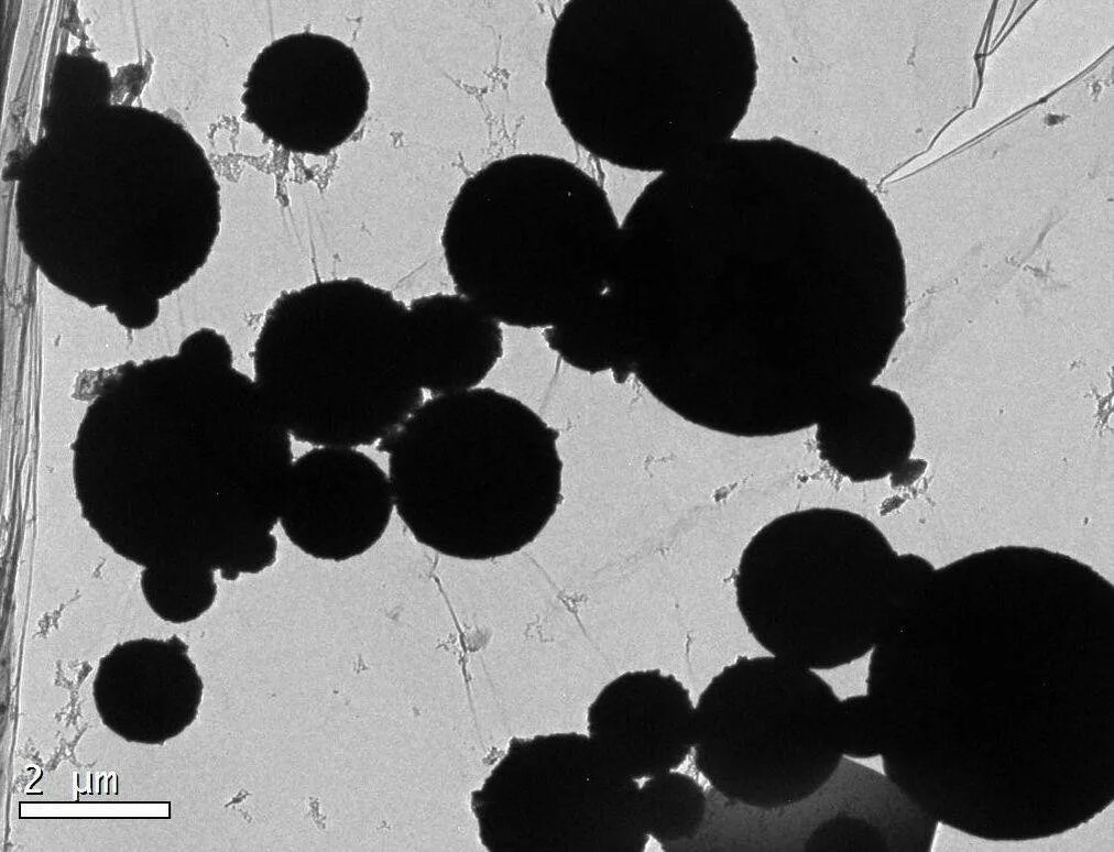 Наночастицы 
К ним относятся образования размером 1-100 нм. Считается, что такие частицы попадают через легкие и кровоток в мозг и мембраны мозга. Нет механизмов выброса этих частиц оттуда. Наличие таких частиц в мозге связано с дегенеративными заболеваниями мозга.