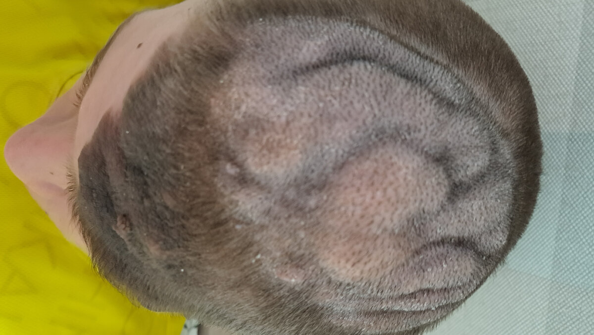 Глеб Столетов, подопечный фонда "Алёша"