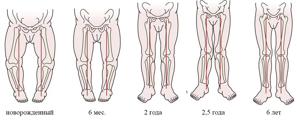 Anonymously please. Girls, please tell me at what age the legs of the child stra