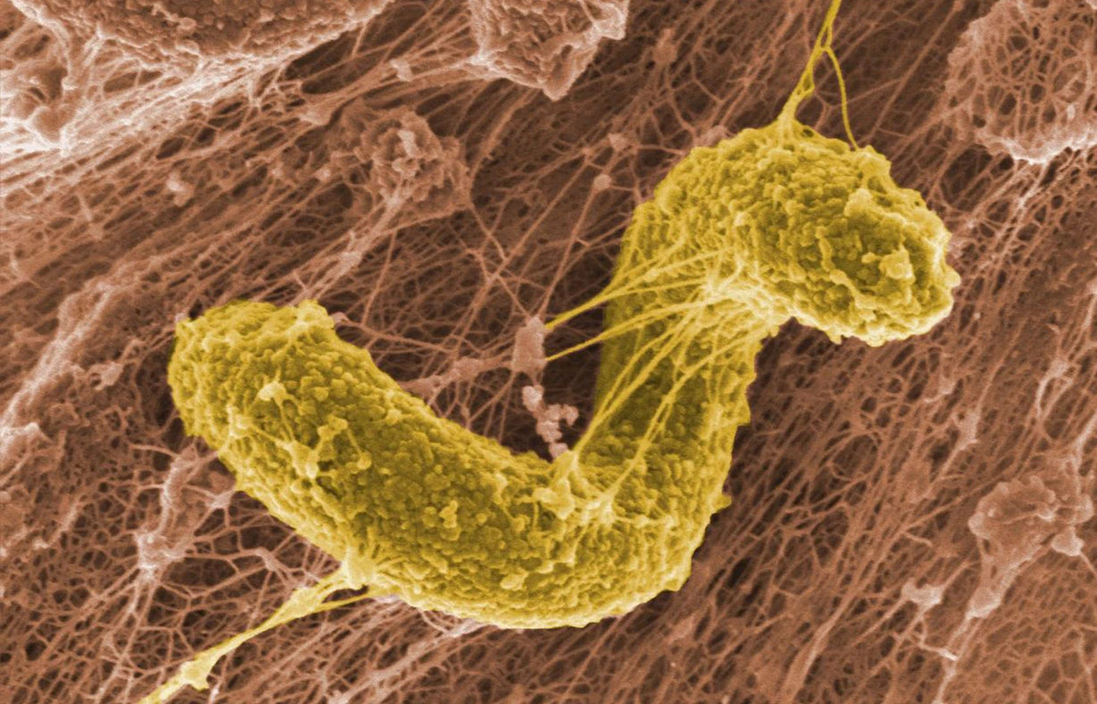 Бактерии Desulfovibrio. Эта группа кишечных бактерий ассоциируется с подавлением иммунной системы, что может способствовать развитию опухолей молочной железы. Фото: PNWL/Alamy