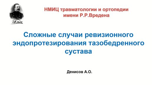 Сложные случаи ревизионноо протезирования тазобедренного сустава.