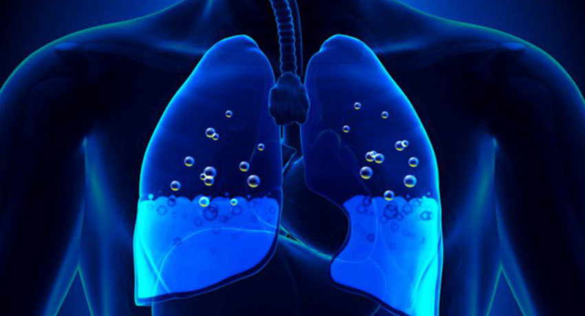 Чем опасна жидкость в легких