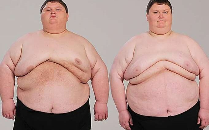 В 19 и 22 года братья вместе весили 420 кг - закормила мама. Похудение, преображение. Но что было дальше?