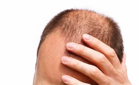 выпадение волос какие анализы сдать