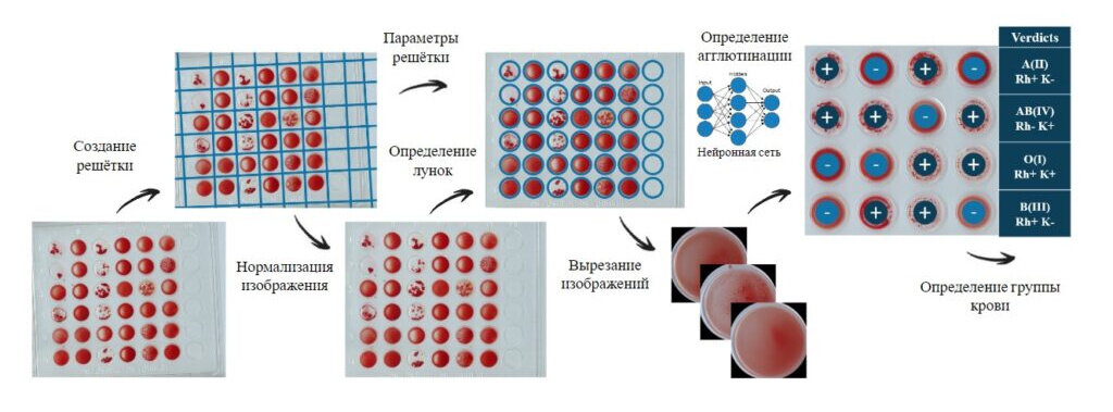 Схема диагностики группы крови Изображение: © Expressto
