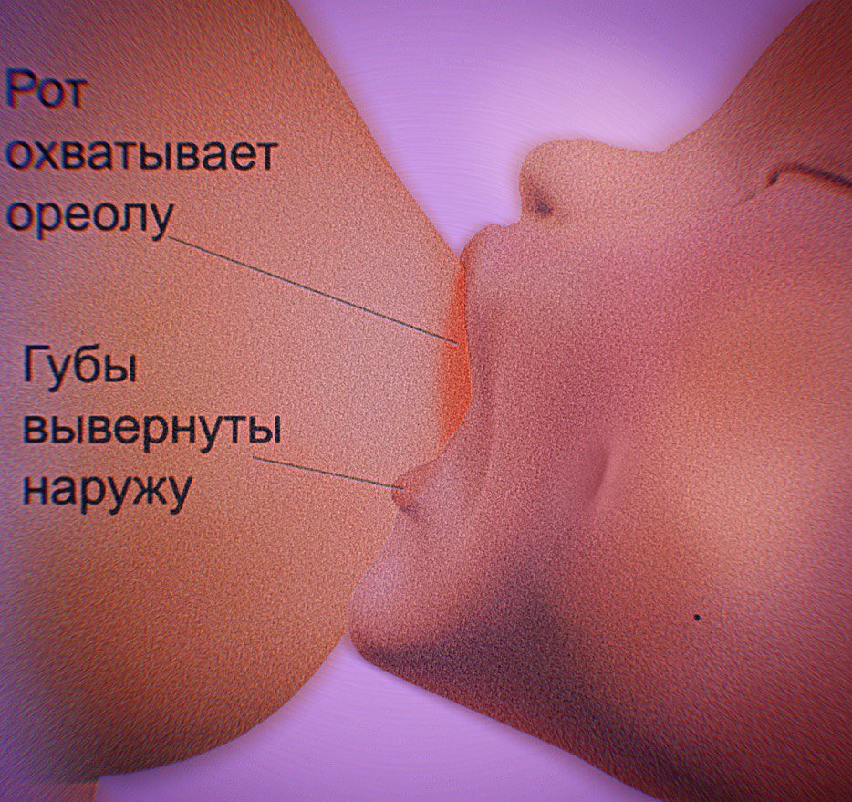 Оптимальное вложения соска