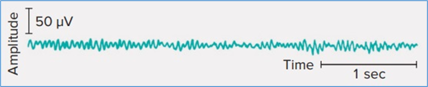 Figure 11.1. EEG patterns are wavelike. This represents a typical EEG recorded from the parietal or occipital lobe of an awake, relaxed person, with a frequency of approximately 20 Hz and an average amplitude of 20 μV. Eric P. Widmaier Human Physiology. The Mechanisms of Body Function, New NY: McGraw-Hill Education. 2019. https://lccn.loc.gov/2017048599