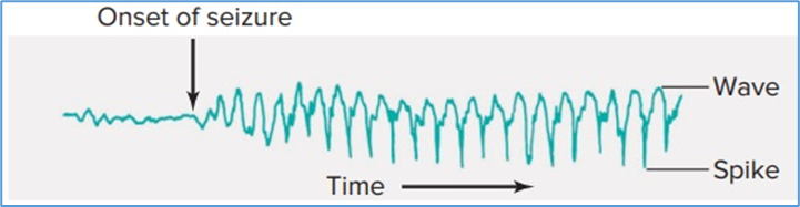 Figure 11.2. Spike-and-wave pattern in the EEG of a patient during an epileptic seizure. Eric P. Widmaier Human Physiology. The Mechanisms of Body Function, New NY: McGraw-Hill Education. 2019. https://lccn.loc.gov/2017048599