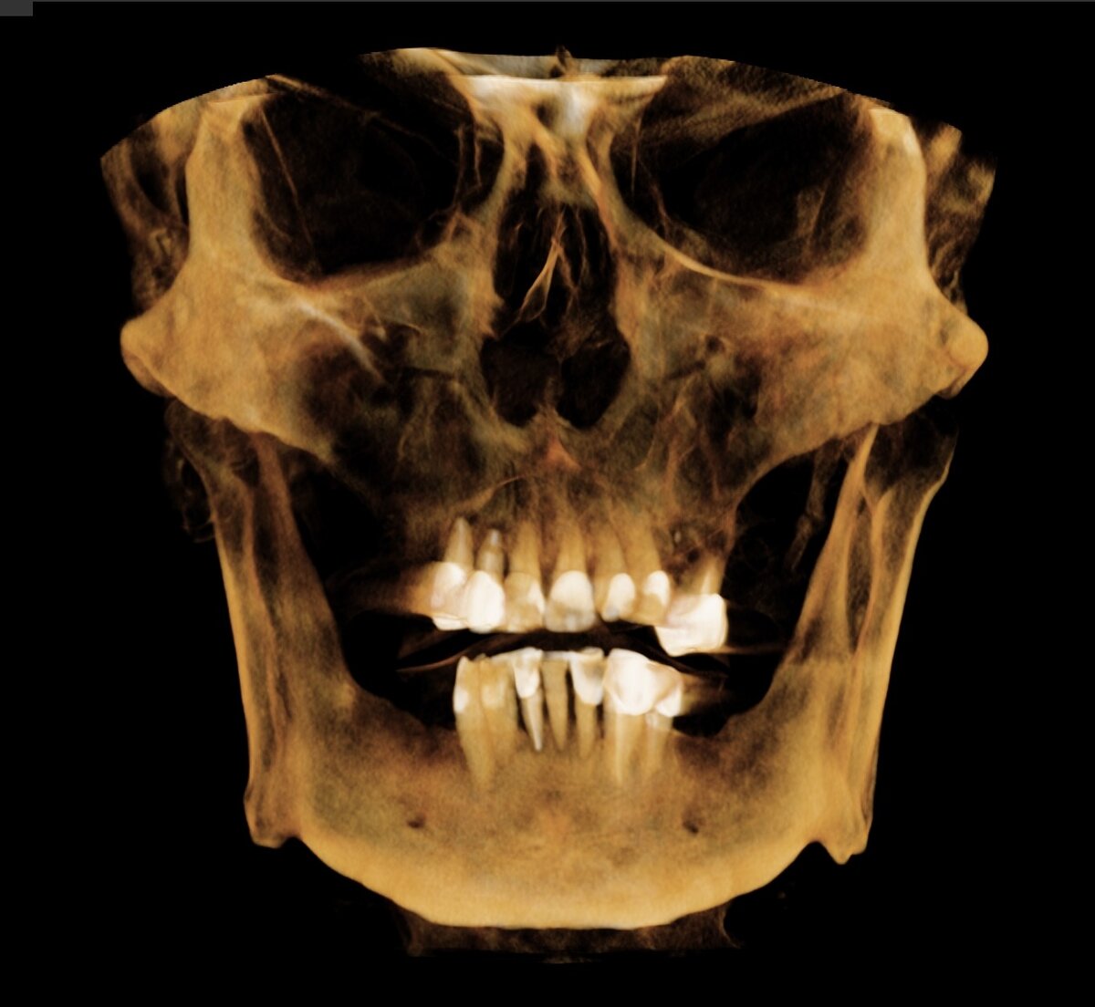 Цифровая визуализация