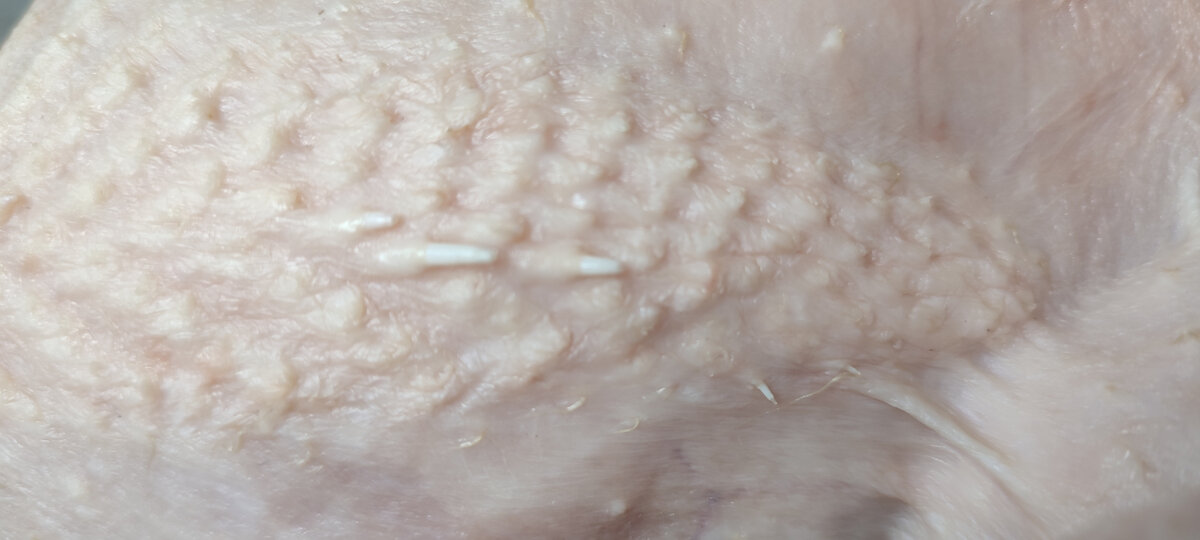 Вот так выглядят эти пеньки.... которые приходиться убирать вручную, с помощью пинцета. 