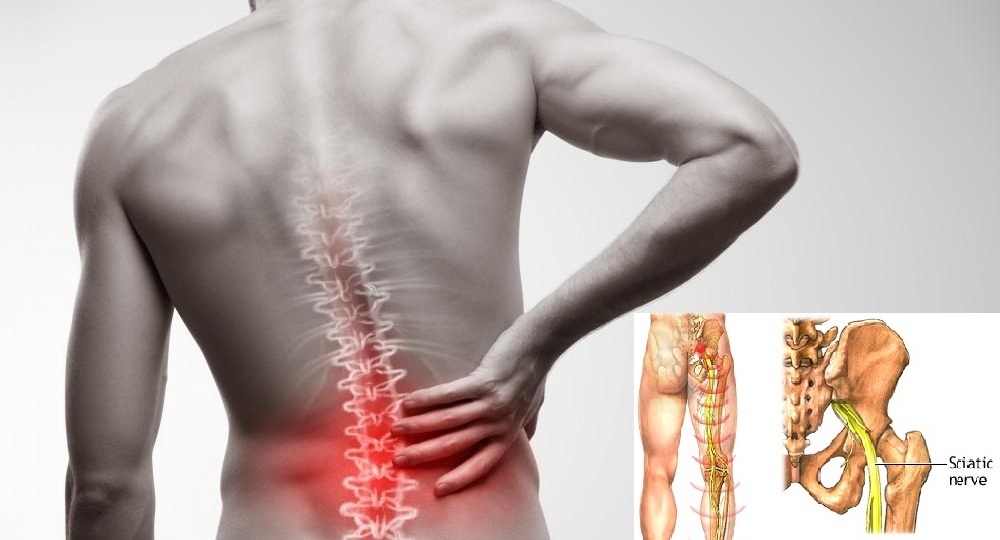 Боли в спине НЕЛЬЗЯ ИГНОРИРОВАТЬ!