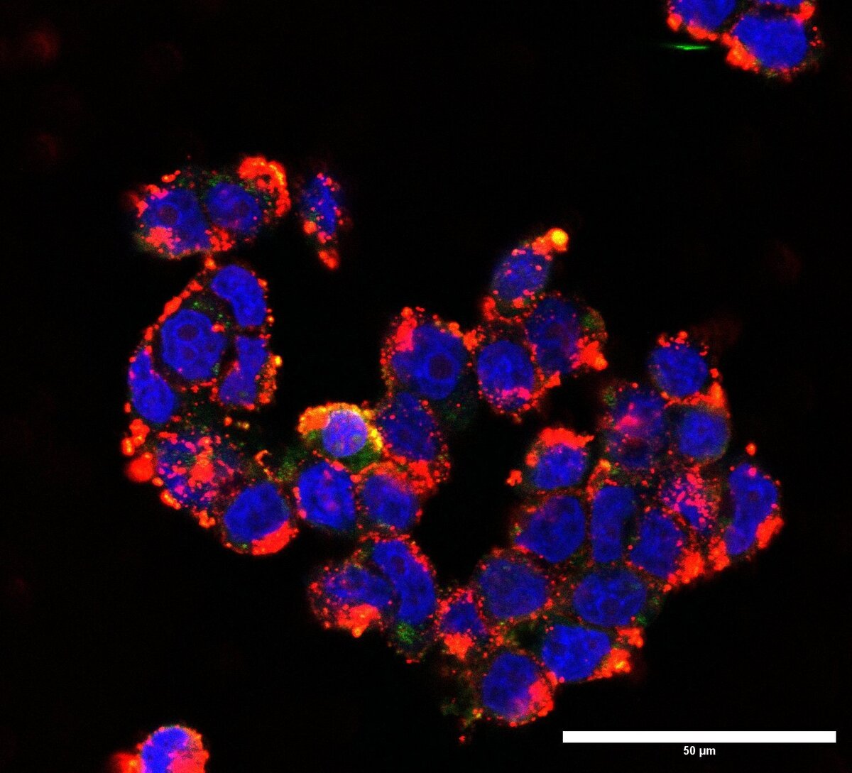    Клетки медуллобластомы после доставки siRNA AF647 с помощью наночастиц, разработанных исследователями AIBN.AIBN