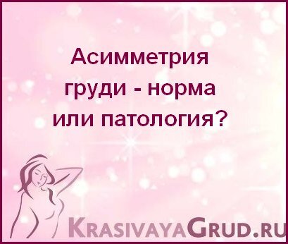 Привет, друзья. Сегодня поговорим о такой деликатной теме, как асимметрия груди у женщин.