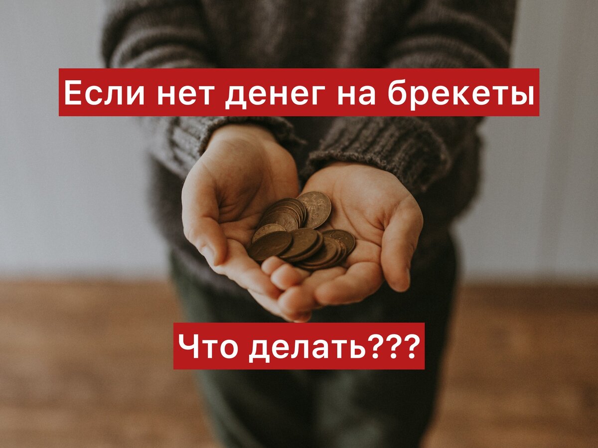 Что делать, когда нет денег на исправление прикуса зубов?