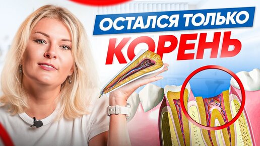 Что делать, если от зуба остался только корень? 3 способа восстановления