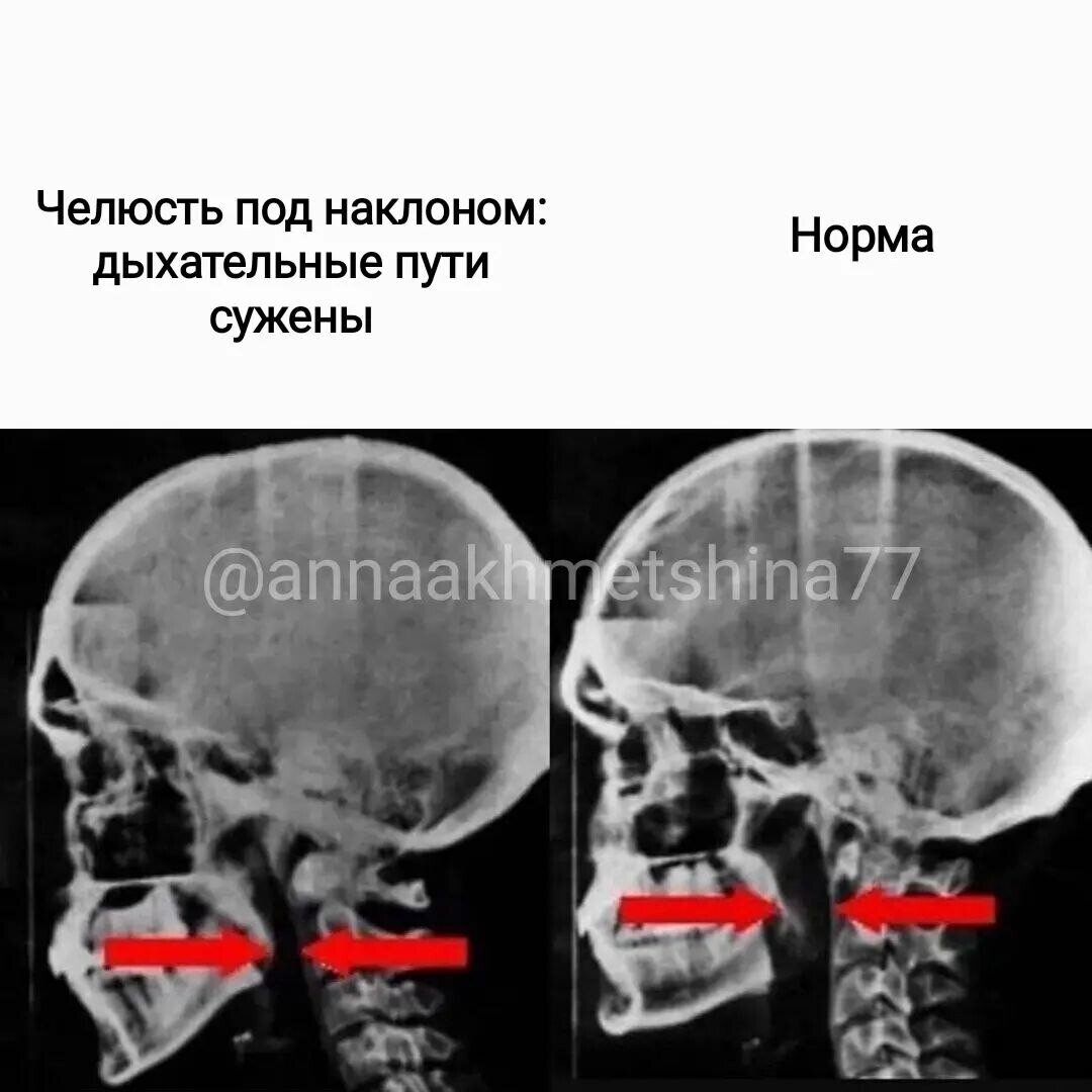 -1-2